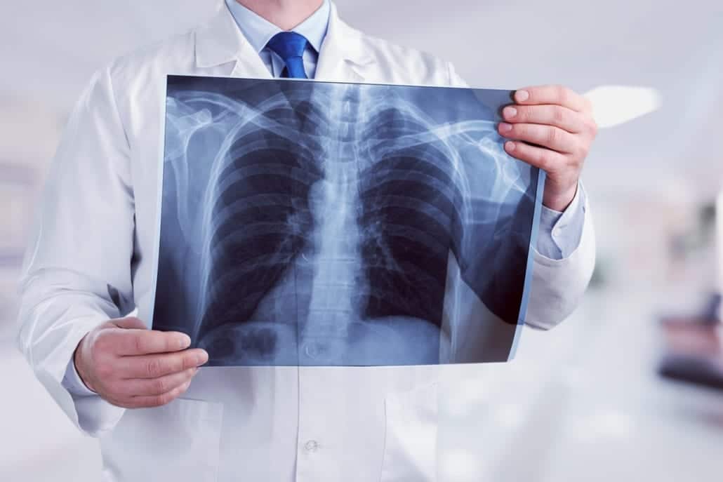 X-Ray-Header-Header-1030x687